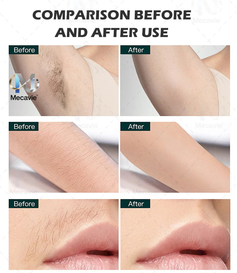 Latest 5000W Diode Laser painless permanent hair removal FAC advanced technology with 4 Waves Salon Exclusive Full Certificate